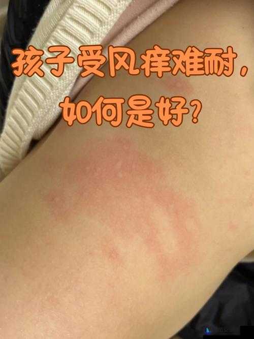 淑芬二腿间瘙痒难耐引发的一系列奇妙经历